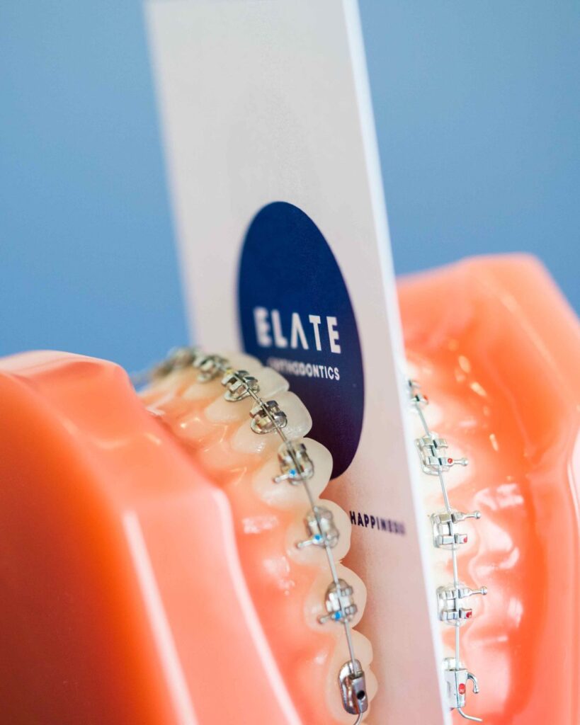 Orthodontist office near Aubrey TX offering braces and Invisalign in Frisco and Prosper.